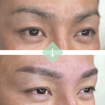 施術例３[before→after]